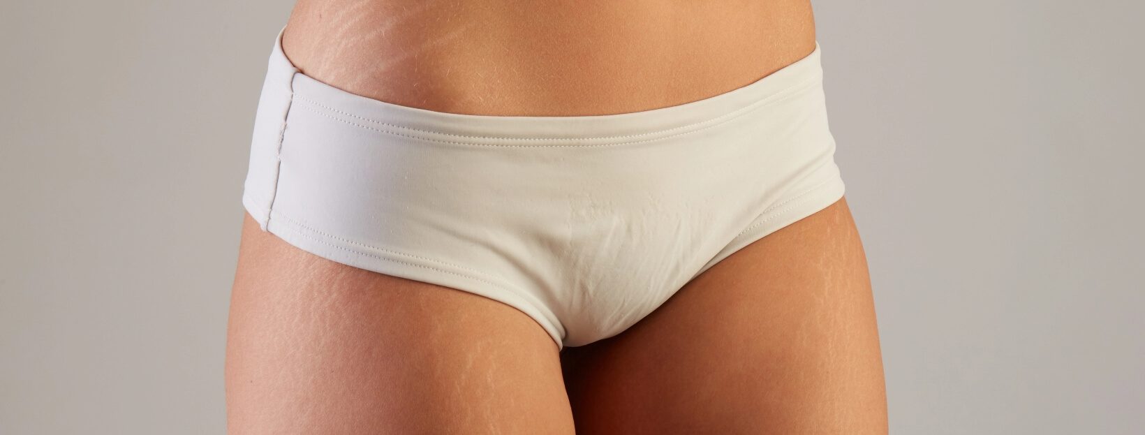 trosyd candidosi vaginale